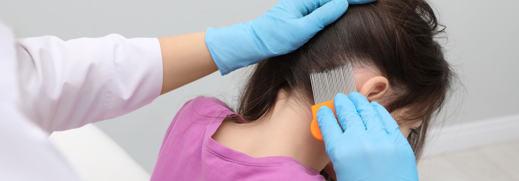 head lice treatment glasgow