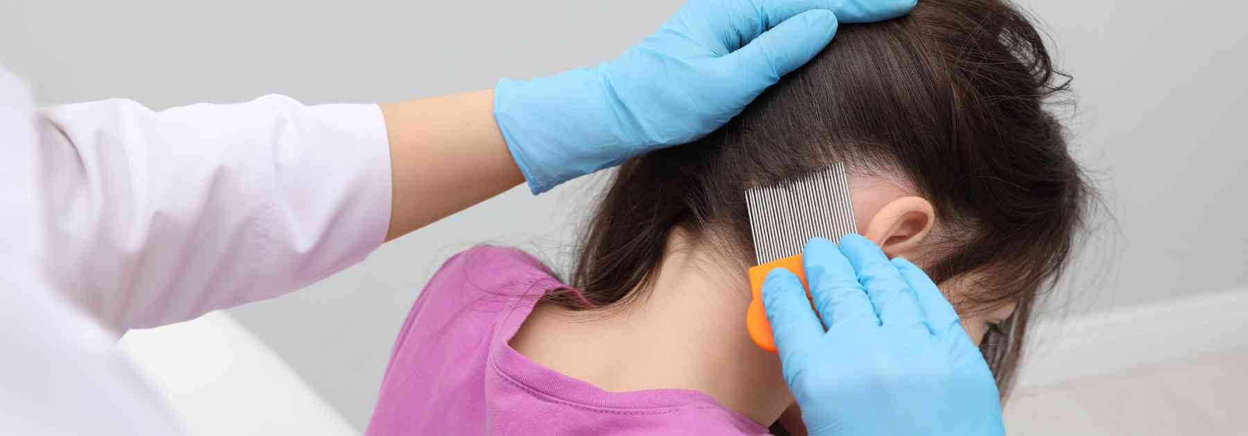 head lice treatment in glasgow